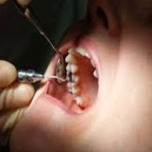 معضل دندان پزشکان قلابی!