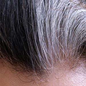 وضعیت های جدی پزشکی را از حالت موهایتان تشخیص دهید