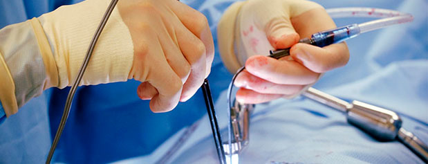 بیماران زیر تیغ آنژیوگرافی‌های غیرضروری