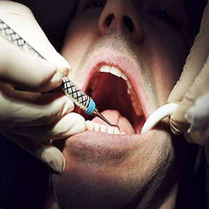 راه اندازی 3200 واحد دندانپزشکی در کشور