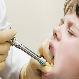 نکاتی برای افرادی که از مراجعه به دندانپزشک وحشت دارند