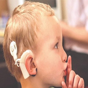 کمبود پروتز شنوایی در کشور/ هزار کودک در صف انتظار حلزون مصنوعی