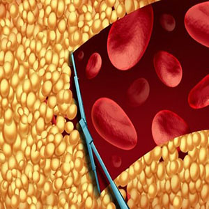 توسعه داروی بدون عوارض برای کاهش کلسترول خون