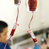 ثبت ۱۱۲۵۰ بیمار هموفیلی و سایر اختلالات خونریزیدهنده در وزارت بهداشت