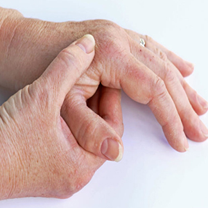 بررسی روش‌های درمانی یک بیماری مفصلی به نام آرتریت پسوریاتیک