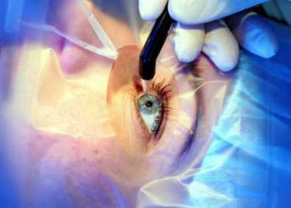 بهترین زمان عمل جراحی چشم