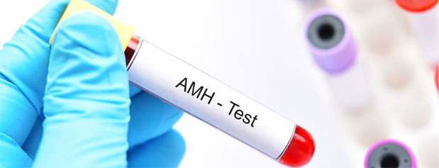 اهمیت تست AMH برای  اندازه گیری ذخیره تخمدان در درمان ناباروری