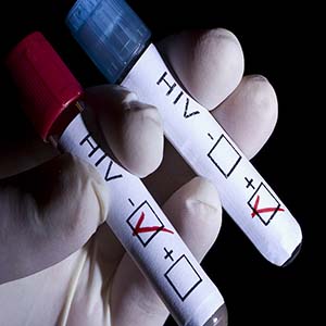 توزیع کیت‌های تست «ایدز» در داروخانه‌ها به کجا رسید؟