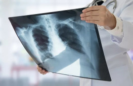 کودکان قربانیان اصلی اشعه ایکس دستگاه‌های رادیولوژی