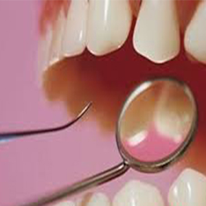 خرابی دندان خطر ابتلا به سرطان مری را افزایش می‌دهد