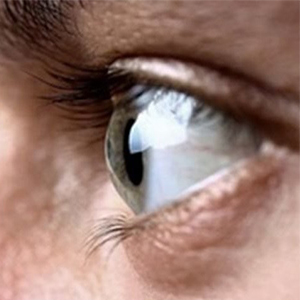 8 درمان طبیعی خشکی چشم