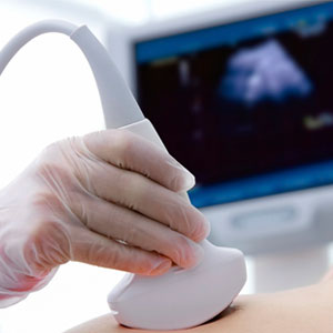 نکاتی مهم درباره سونوگرافی بارداری