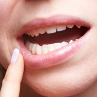 7 درمان خانگی برای زخم‌های دهان