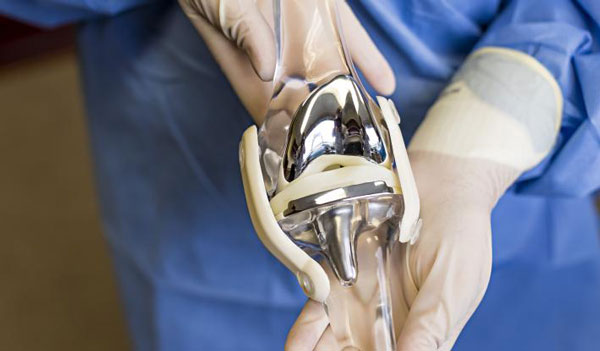 گزارشی جامع از جراحی های تعویض مفصل زانو در کشور ارائه کنید