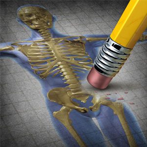 9 نشانه پنهان بروز مشکل در استخوان‌ها