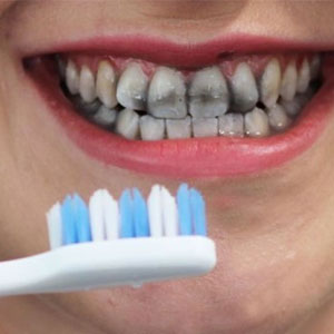 آیا خمیر دندان‌های ذغالی واقعی هستند و دندان‌ها را سفید می‌کنند؟