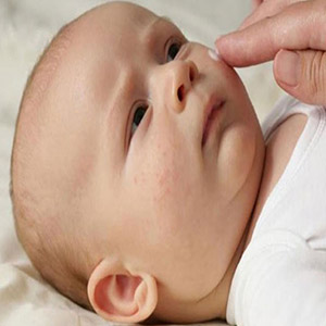 نوزادان مبتلا به اگزما در معرض ریسک بالاتر ابتلا به آلرژی غذایی