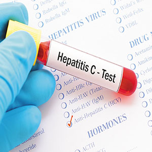 چگونه از هپاتیت C جان سالم به در ببریم؟