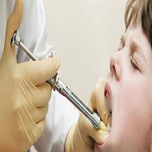 فروش«کارپول»دندانپزشکی در بازار غیر رسمی/ماجرای ارز تجهیزات پزشکی