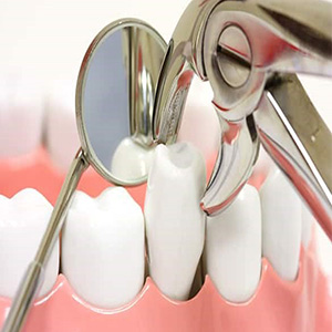 مراقبت‌های پس از کشیدن دندان