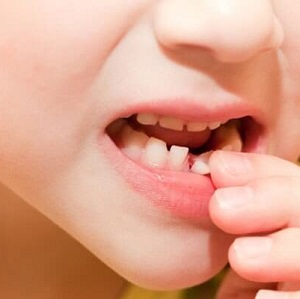 «چاقی» و « بهداشت دهان و دندان» مهمترین مشکلات سلامتی دانش‌آموزان