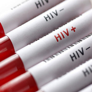 بیماری HIV قابل درمان است