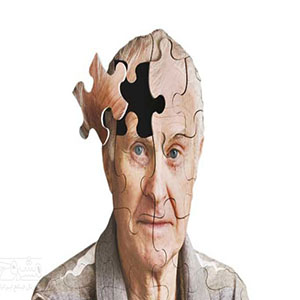 یک سوم موارد بروز آلزایمر در سالمندان قابل پیشگیری است
