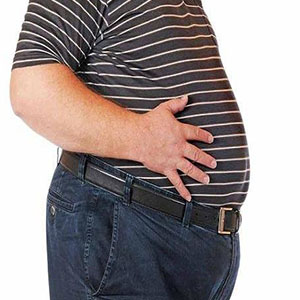 ۲۲ درصد جمعیت بالغ کشور کاملا چاق هستند