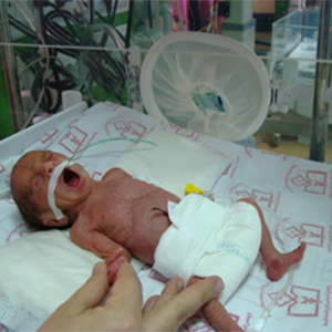 بین ۸ تا ۱۰ درصد نوزادان ایرانی نارس هستند
