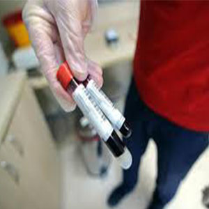 افزایش موارد بروز آنفلوآنزا در کشور/مردم نکات بهداشتی را رعایت کنند