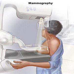 آنچه «زنان »باید درباره ماموگرافی بدانند