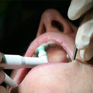 مراکز دندانپزشکی از هیچ تعرفه ای پیروی نمی کنند