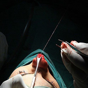 وقتی پای غیر پزشک‌ها به جراحی‌های زیبایی باز می‌شود