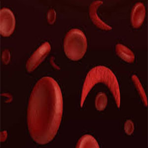 خطر مرگ زودرس بر اثر کاهش نوعی سلول‌ خونی
