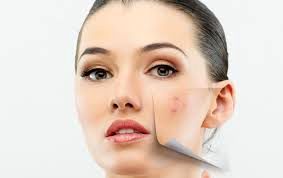 عوامل ایجاد لک های پوستی را بشناسید