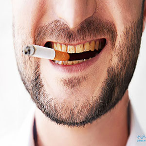 دردسرهای سیگار برای دهان و دندان!