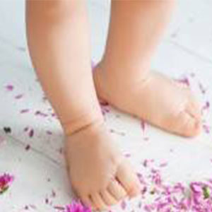 «پای پرانتزی» نوزادان در چه سنی قابل تشخیص است؟
