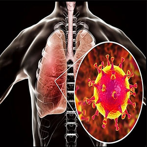 دیابت و افزایش خطر ابتلا به عفونت‌های تنفسی ویروسی