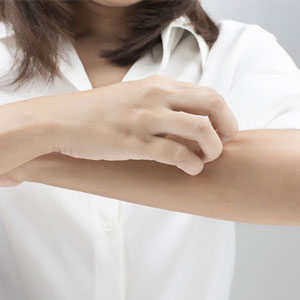 درمان خشکی پوست دست پس از شستشوی زیاد