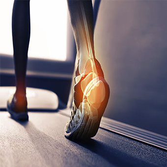 9 دلیل برای درد پا هنگام راه رفتن!