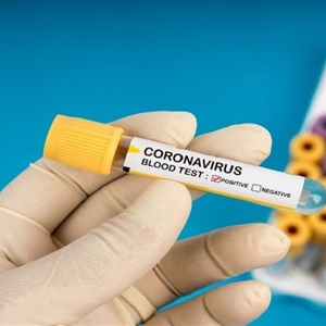 خطر استفاده از درمان‌های آزمایش‌نشده كرونا