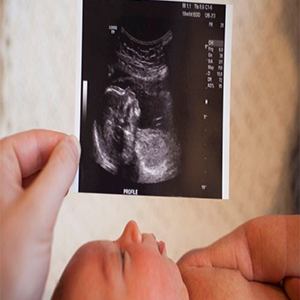 وقتی نیمی از متولدان، سقط می‌شوند