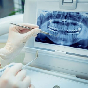 عکس دندانپزشکی، خطری بالقوه برای سلامت