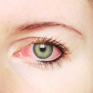 چگونه از آلودگی چشم‌ها به ویروس كرونا جلوگیری كنیم؟