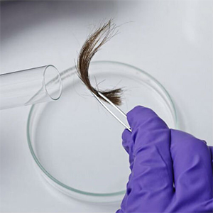 پیش‌بینی میزان باروری زنان با آزمایش موی سر