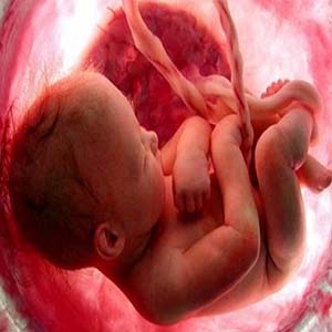 عوارض مرگبار سقط‌‌‌ های عمدی برای زنان باردار