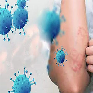 اگر ویروس کرونا روی پوستمان بنشیند چه می‌شود؟