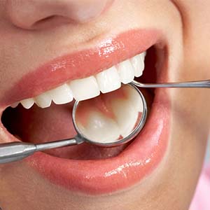 چگونه از سلامت دهان در برابر استرس محافظت کنیم؟