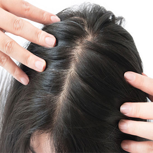 درد پوست سر هنگام حرکت مو؛ از دلایل تا درمان