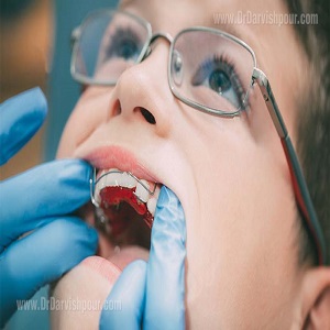 سه روش قطعی برای پیشگیری از کج شدن دندان کودکان
